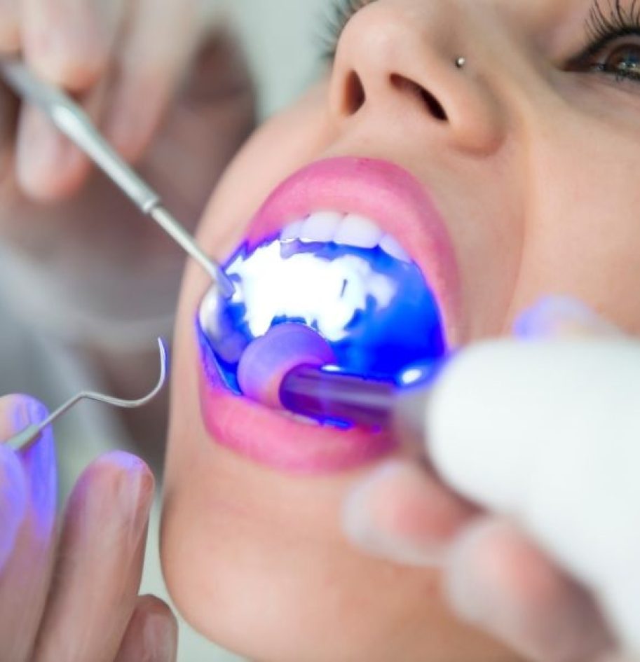 dental-treatments-image